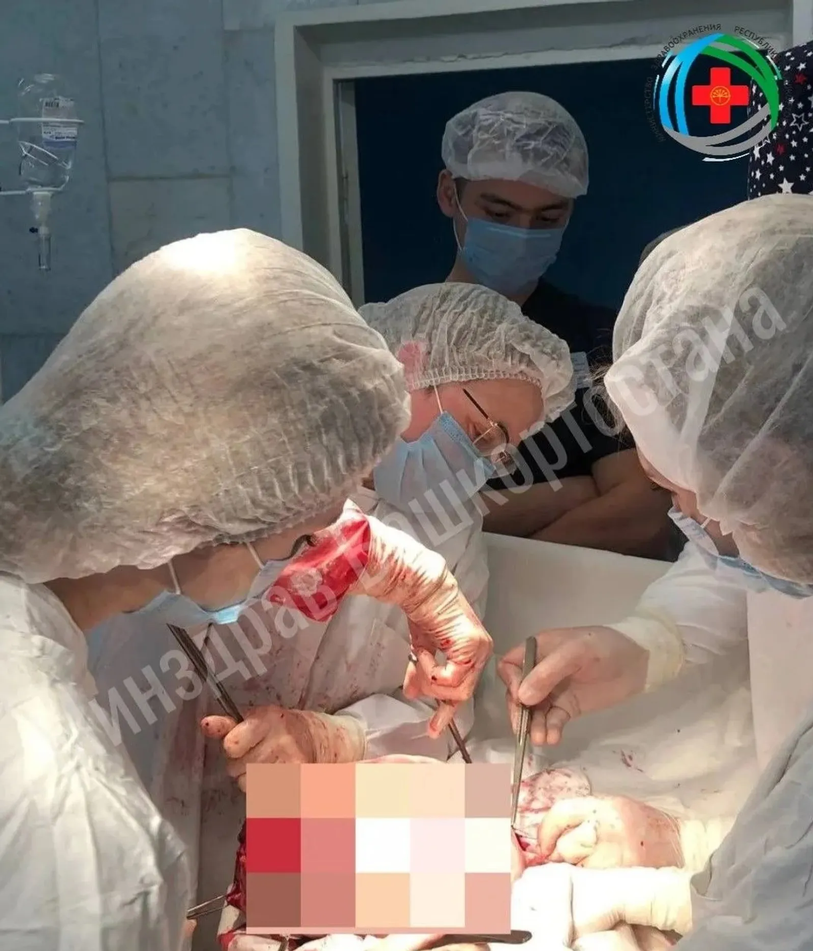 В Уфе врачи удалили у пациентки гигантскую миому матки